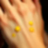 Close-up of yellow skin spots on a hand