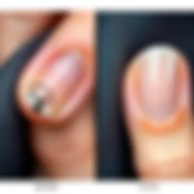 Nail Repair Transformation Before and after comparison of a repaired nail showcasing recovery