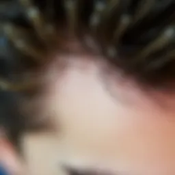 Close-up view of dry scalp exhibiting dandruff flakes