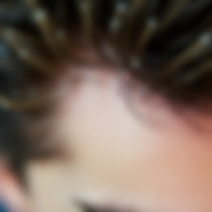 Close-up view of dry scalp exhibiting dandruff flakes