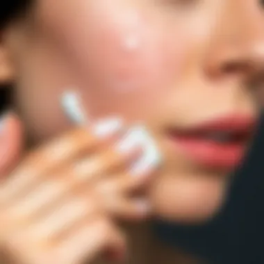 Application of Acne Cream Person applying acne cream on their face