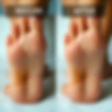 Transformative Results of Heel Care Using a Foot File Before and after results of heel care with a foot file