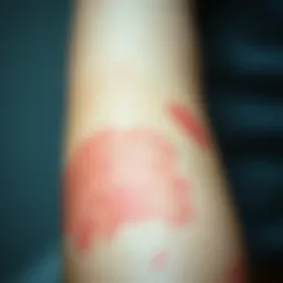 Close-up view of red skin rashes on a person's arm
