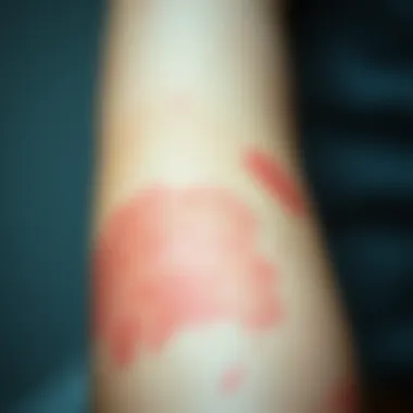 Red Skin Rashes on Arm Close-up view of red skin rashes on a person's arm